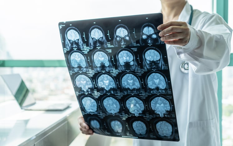 Brain Injury Law in St. George