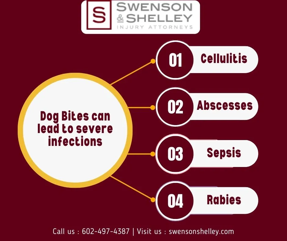This Infographic shows that Dog Bites can lead to severe infections