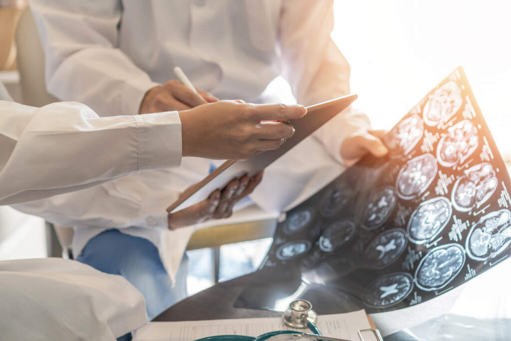 Doctor holding a brain X-ray scan while consulting on a case with a Brain Injury Lawyer in Boise